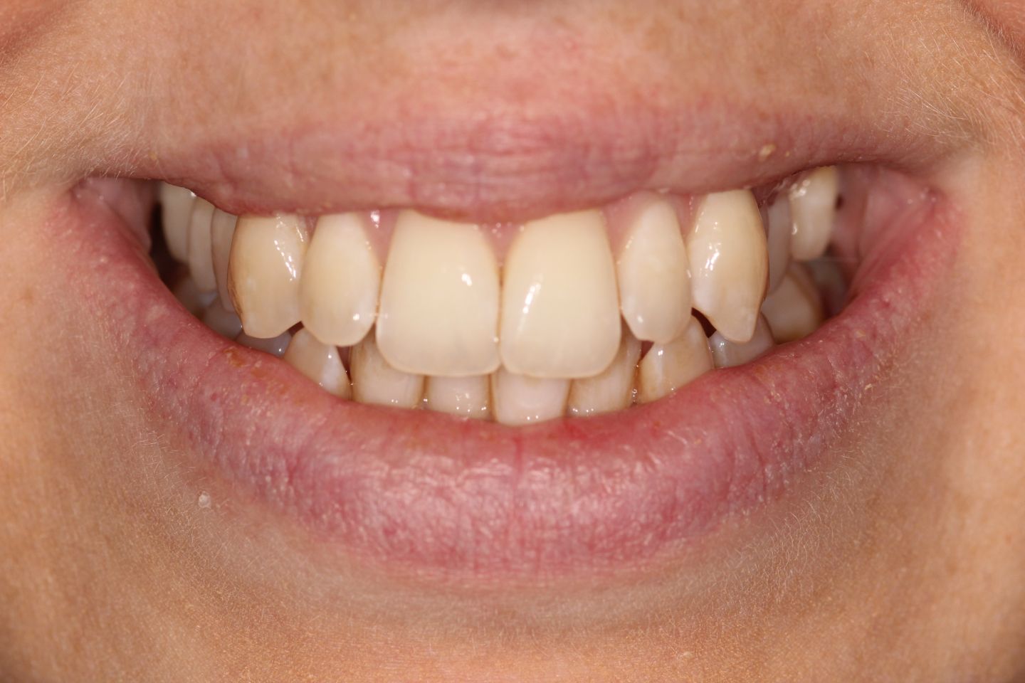 Jennie - Hygiene, Invisalign, whitening