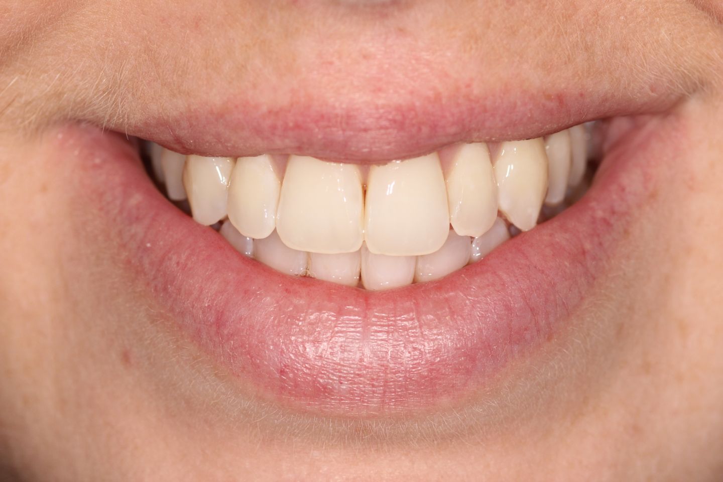 Jennie - Hygiene, Invisalign, whitening